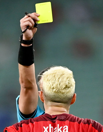 Кто из игроков может пропустить решающие матчи Евро из-за "горчичников"